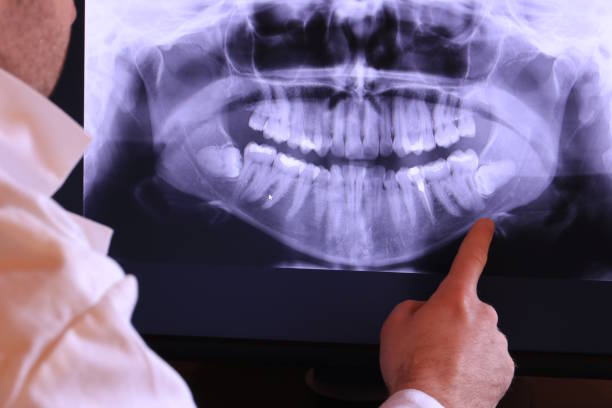 Best Emergency Wisdom Teeth Removal in Dulles Town Center, VA